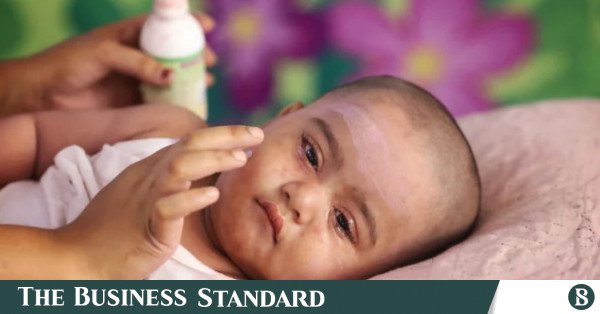 1780036913_measles_tbs.jpg