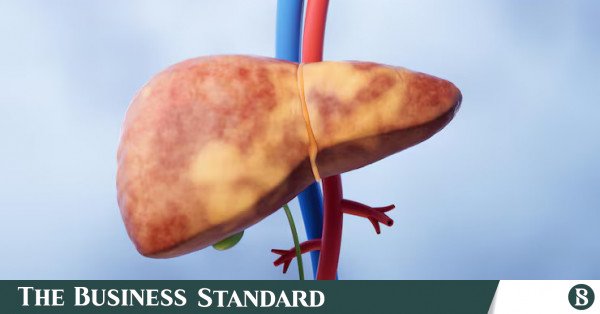 fatty_liver.jpg
