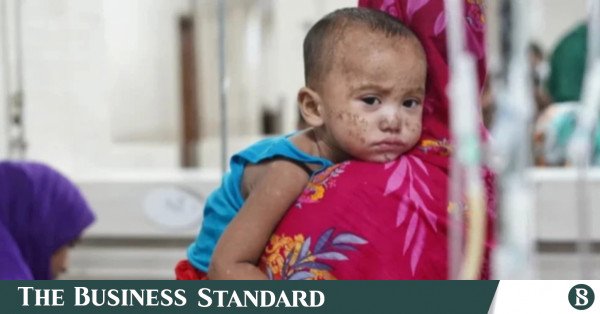 1792060799_measles.jpg